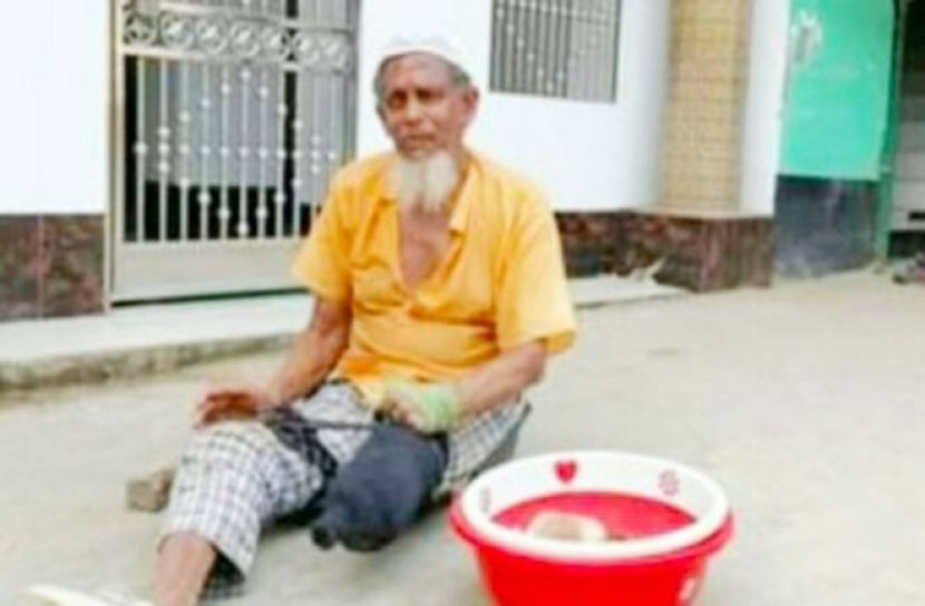 মালেকের হুইল চেয়ারটিও ভাঙা, হামাগুড়ি দিয়ে হাত পাতেন