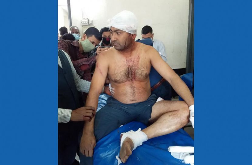 কুলাউড়ায় প্রতিপক্ষের হামলায় যুবলীগ নেতা আহত