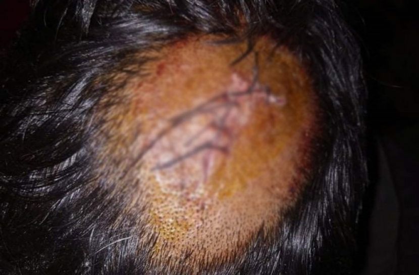 ৬ হাজার টাকার জন্য মাথা ফাটালো এনজিও পরিচালক 