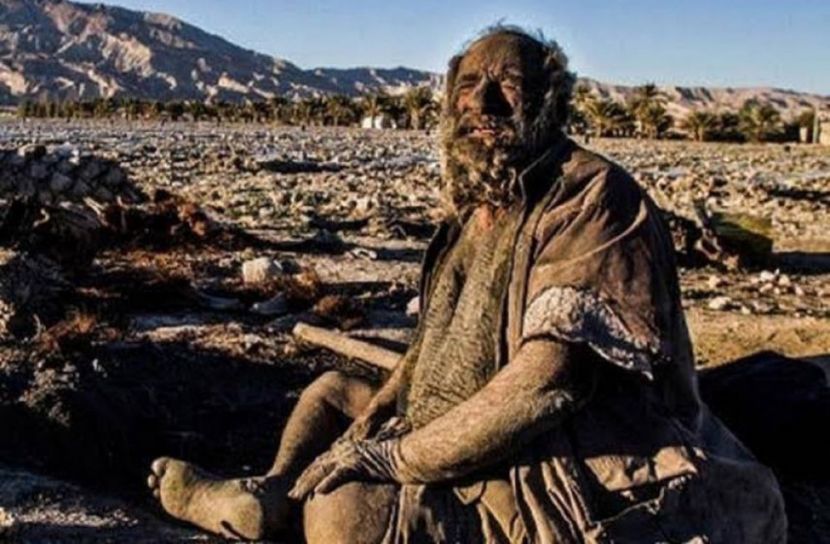 ৭ দশক ধরে গোসল করেন না তিনি, খান পচা মাংস!