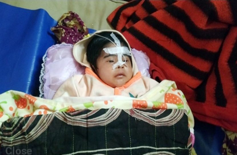 শীত বাড়ায় নিউমোনিয়ায় বেশি আক্রান্ত হচ্ছে শিশুরা