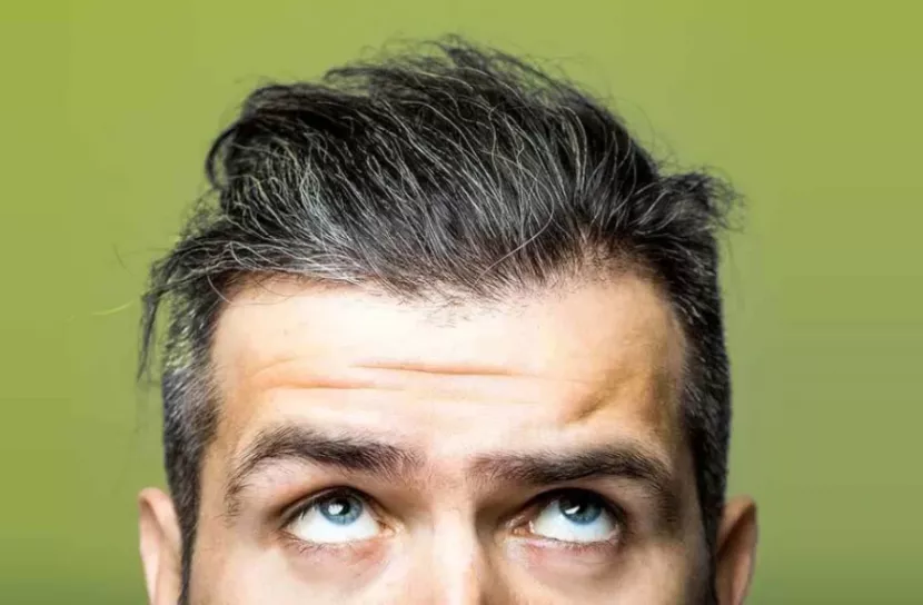 অল্প বয়সে চুল পাকছে? জেনেনিন সমাধান