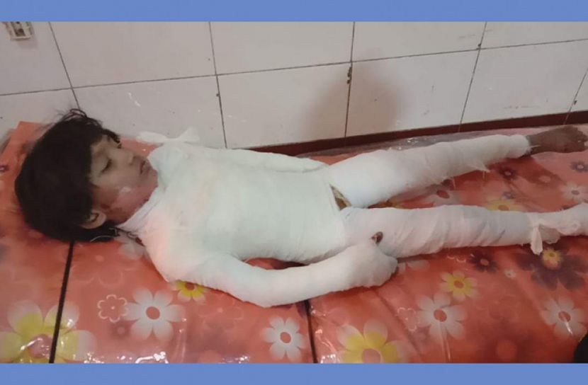 আগুন পোহাতে গিয়ে ৭ বছরের শিশু দগ্ধ