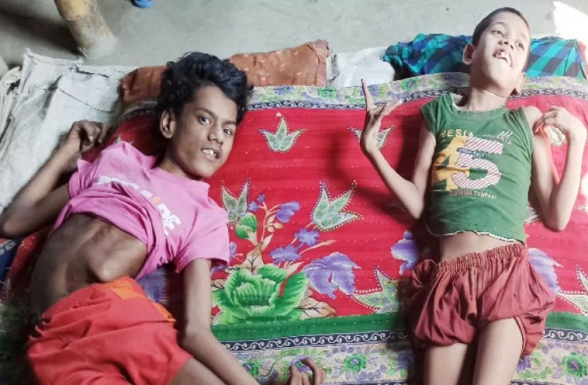 দুই প্রতিবন্ধী সন্তানকে নিয়ে বিপাকে হাসিনা বেগম 