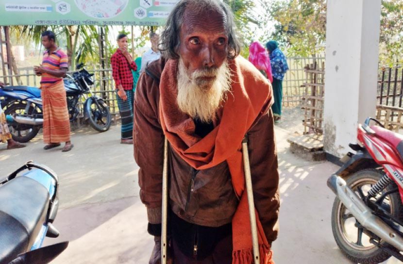 ভাতার জন্য একাউন্ট করতে এসে বিড়ম্বনায় প্রতিবন্ধী ও বয়স্করা