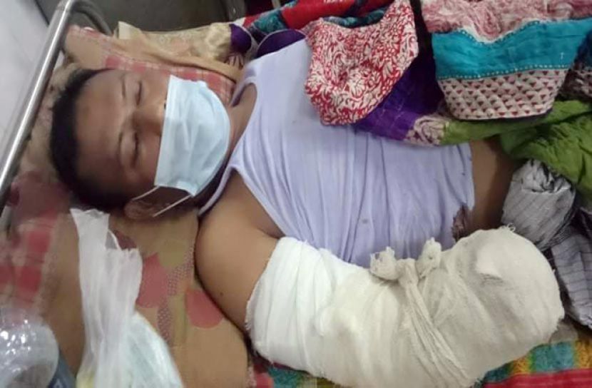 হাত হারাতে হলো দুর্বৃত্তদের হামলায় আহত যুবলীগ নেতার