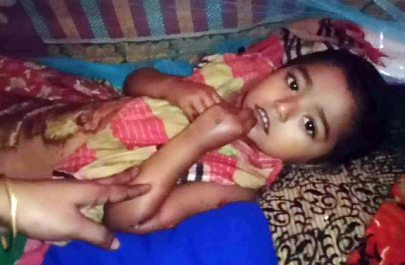 ব্রাহ্মণবাড়িয়ায় এক মাসে শিশুসহ দগ্ধ ৭ 