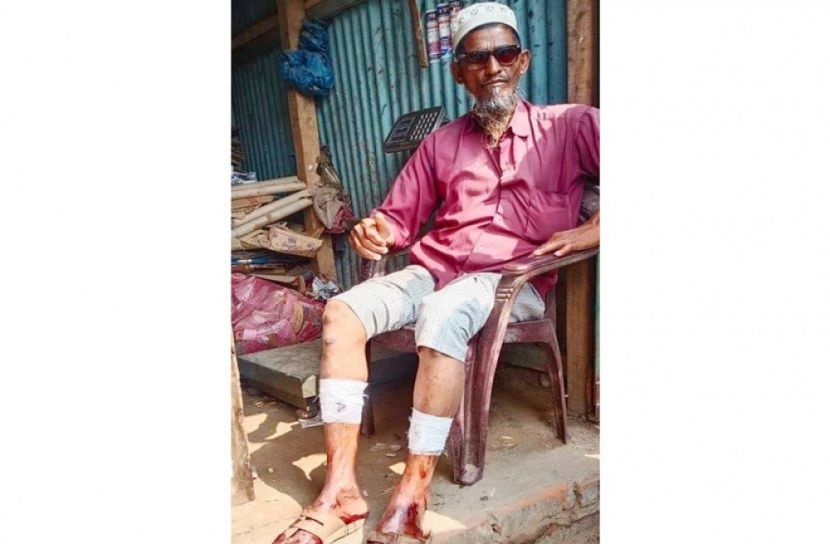 ভোটে হারায় সংঘর্ষ, কাউন্সিলরসহ আটক ২ 