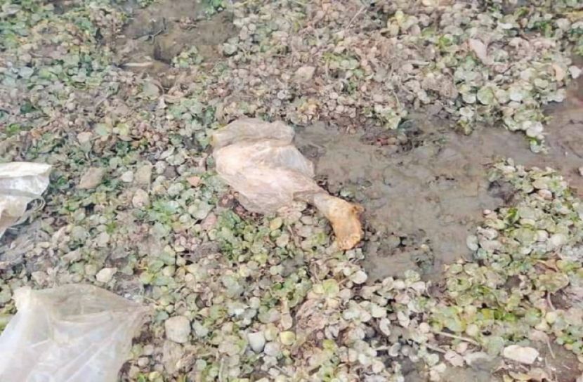 গাইবান্ধায় মানুষের হাটু থেকে কাটা পা উদ্ধার! 