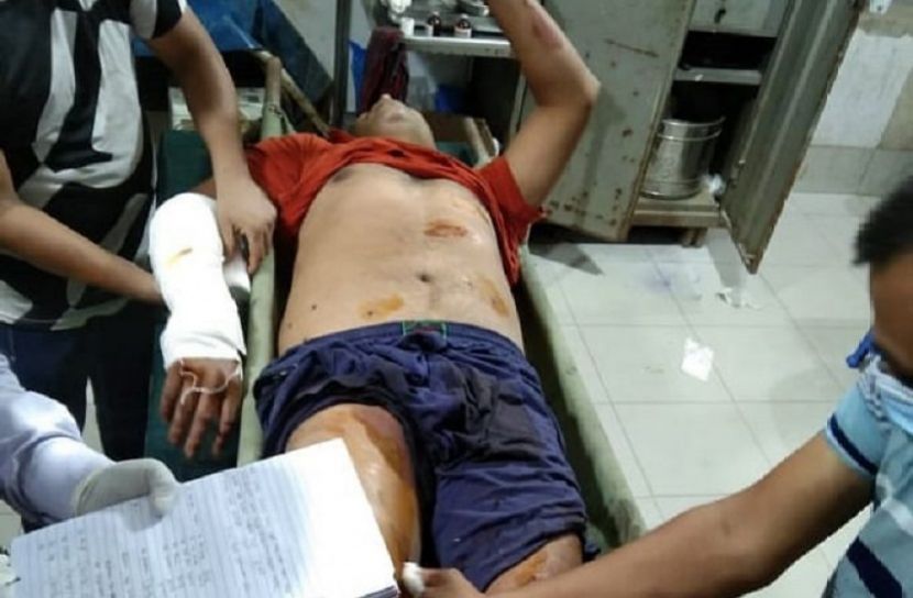 কাদের মির্জার ৭ অনুসারী গুলিবিদ্ধ
