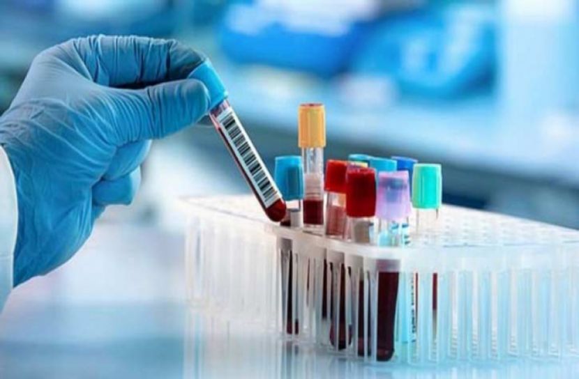 খুলনায় শনাক্ত ৫০ হাজার, মৃত্যু ২৩