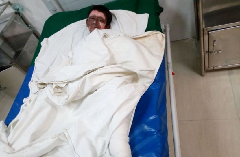 গ্যাস সিলিন্ডার লিকেজে অগ্নিকাণ্ড, দগ্ধ ৫