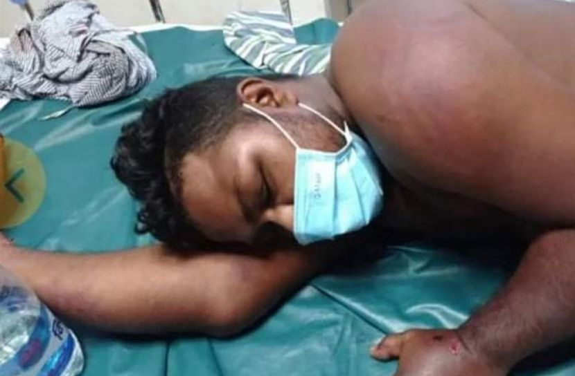 ছুরি হাতে আইসিইউতে  করোনা রোগীর তাণ্ডব