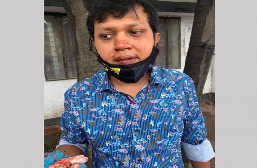 হিজড়াদের মারধরে বাসযাত্রী আহত 