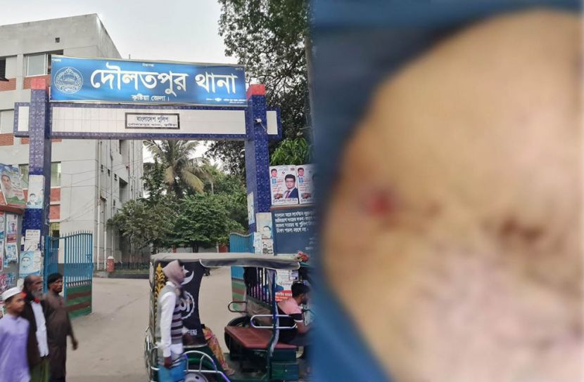 কুষ্টিয়ায় দুর্বৃত্তের গুলিতে কৃষক নিহত, গুলিবিদ্ধ ২