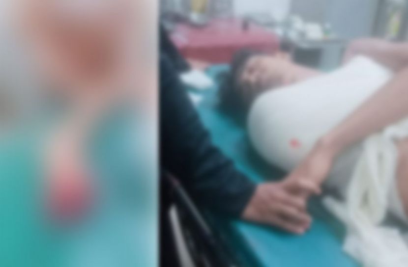 নোয়াখালীতে ট্রাকের ধাক্কায় তরুণের হাত বিচ্ছিন্ন