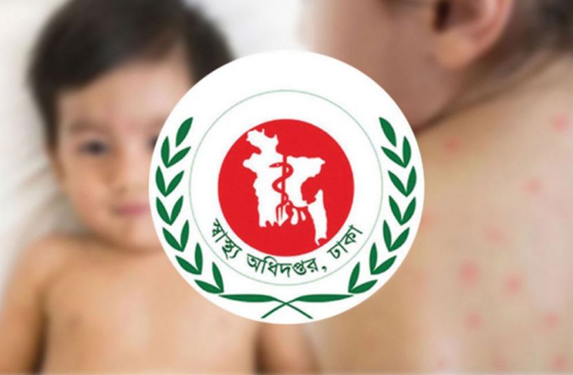 হাম রোগের সর্বশেষ প্রতিবেদন