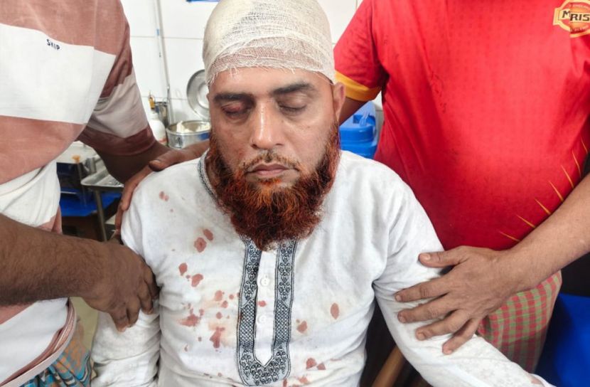 নোয়াখালীতে হোটেল ম্যানেজারকে কুপিয়ে জখম, ৫ লাখ টাকা লুট